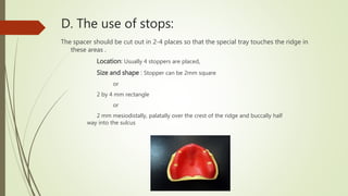 D. The use of stops:
The spacer should be cut out in 2-4 places so that the special tray touches the ridge in
these areas .
Location: Usually 4 stoppers are placed,
Size and shape : Stopper can be 2mm square
or
2 by 4 mm rectangle
or
2 mm mesiodistally, palatally over the crest of the ridge and buccally half
way into the sulcus
 