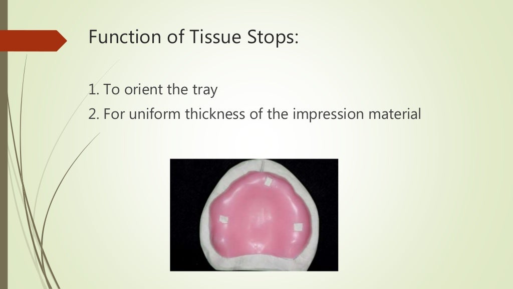 Beginner Guide to Impression Trays in Dentistry
