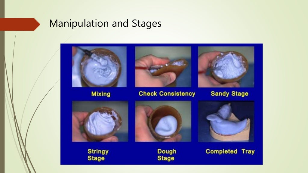 Beginner Guide to Impression Trays in Dentistry