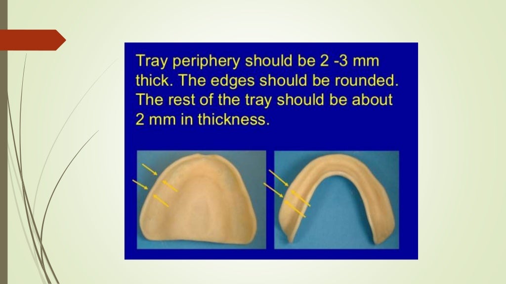 Beginner Guide to Impression Trays in Dentistry