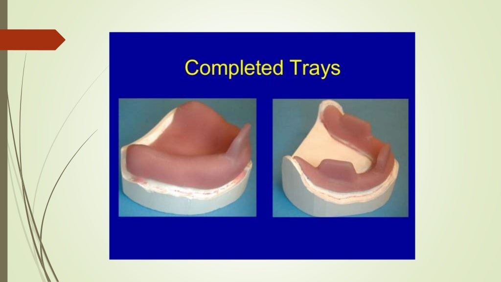 Beginner Guide to Impression Trays in Dentistry