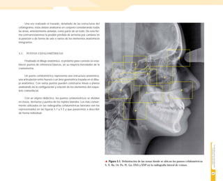 referencias cefalometricas para realizar un trazado cefalometrico | PDF