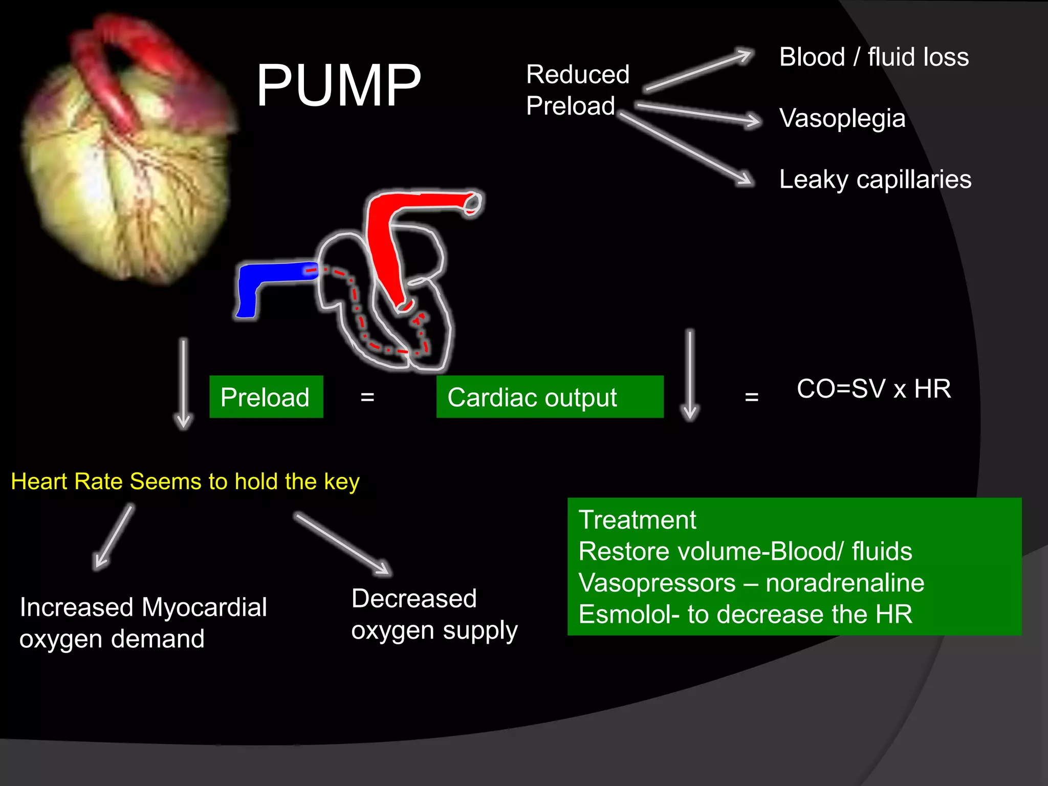 Preload Fluids Hypotension management in ICU, volume vessel or pump? | PPTX