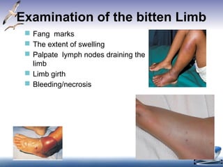 Examination of the bitten Limb
 Fang marks
 The extent of swelling
 Palpate lymph nodes draining the
limb
 Limb girth
 Bleeding/necrosis
15
Progressive painful swelling is indicative of local venom toxicity. It is prominent in
Russel’s viper bite, Saw scaled viper bite and Cobra bite. This is associated with
• Local necrosis which often has a rancid smell. Limb is swollen and the skin is taut
and shiny. Blistering with reddish black fluid at and around the bite site. Skip
lesions around main lesion are also seen. (Figure 5).
• Ecchymoses due to venom action destroying blood vessel wall.
• Significant painful swelling potentially involving the whole limb and
extending onto the trunk.
• Compartment syndrome will present invariably.
• Regional tender enlarged lymphadenopathy.
 
