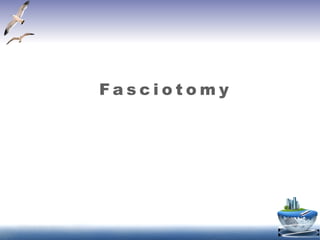 F a s c i o t o m y
 