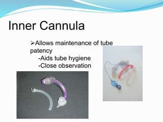 Tube Patency Tracheostomy | PPTX
