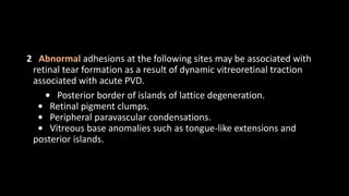 Traction Rd Fundus Tractional RD | PPTX