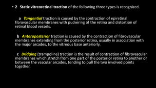 Traction Rd Fundus Tractional RD | PPTX