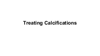 Treating Calcifications

 