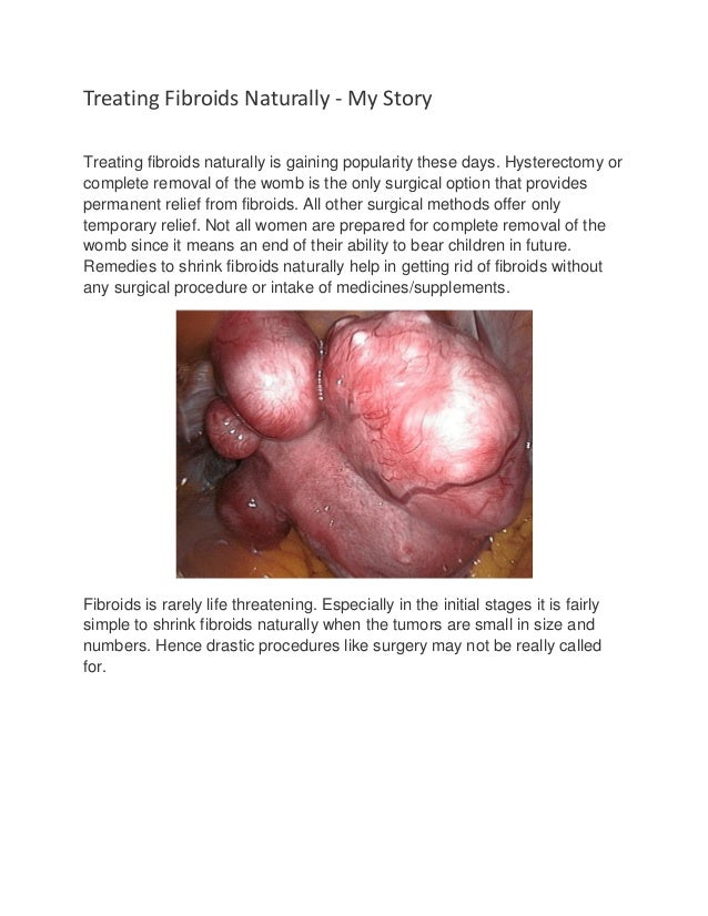 Best Way To Shrink Fibroids Naturally Best Way To Shrink Fibroids Naturally