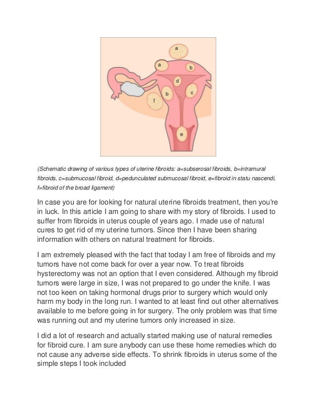 How To Rid Fibroids Naturally How To Rid Fibroids Naturally