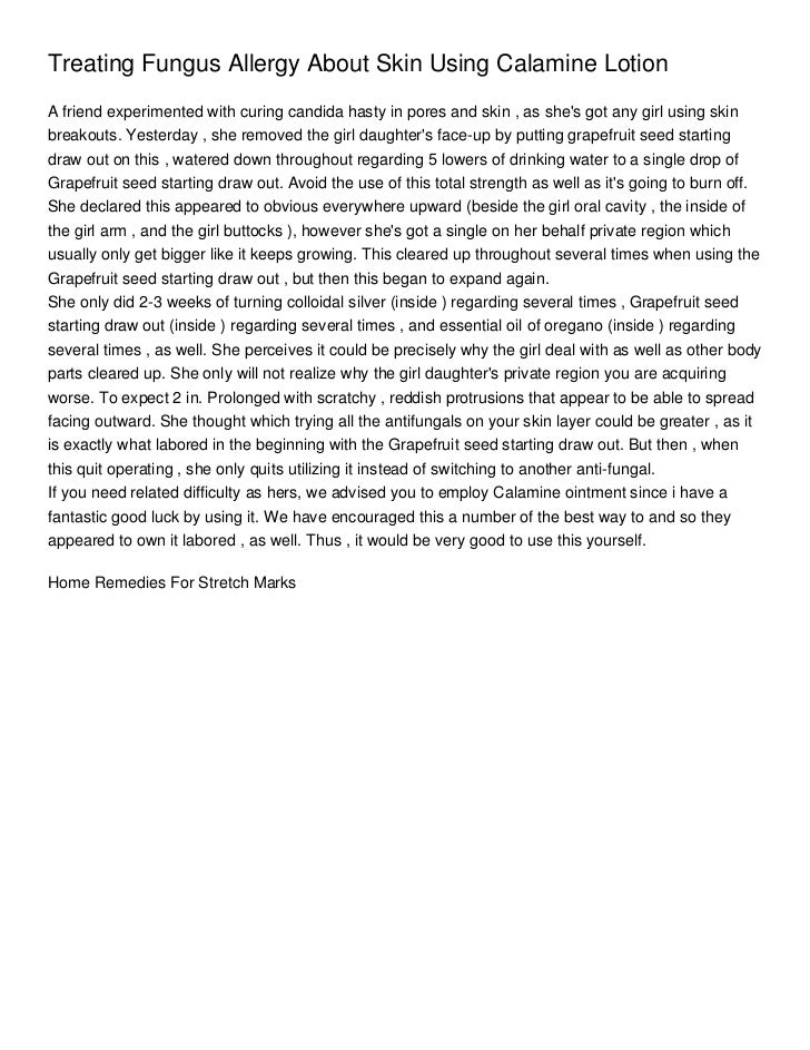 calamine lotion stretch marks