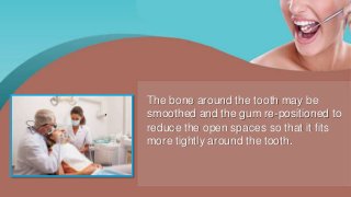 The bone around the tooth may be
smoothed and the gum re-positioned to
reduce the open spaces so that it fits
more tightly around the tooth.
 