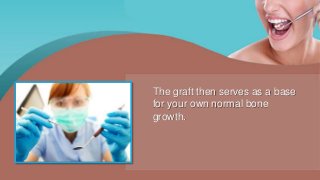 The graft then serves as a base
for your own normal bone
growth.
 