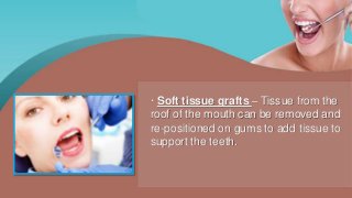 · Soft tissue grafts – Tissue from the
roof of the mouth can be removed and
re-positioned on gums to add tissue to
support the teeth.
 