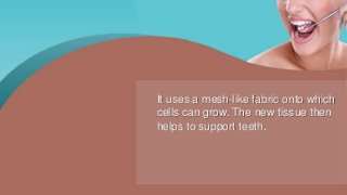 It uses a mesh-like fabric onto which
cells can grow. The new tissue then
helps to support teeth.
 
