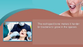 The reshaped bone makes it harder
for bacteria to grow in the spaces.
 