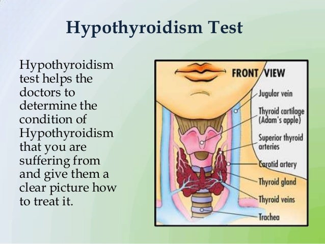 How To Treat Hypothyroidism Naturally How To Treat Hypothyroidism Naturally
