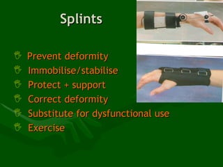 Hand Therapy - Treatment Modalities Of The Wrist | PPT