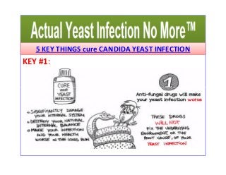 5 KEY THINGS cure CANDIDA YEAST INFECTION 
KEY #1: 
 