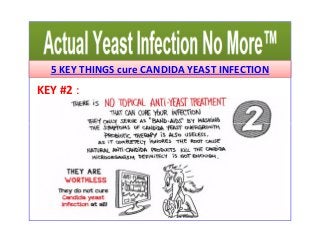 5 KEY THINGS cure CANDIDA YEAST INFECTION 
KEY #2 : 
 