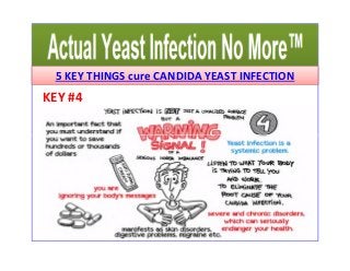 5 KEY THINGS cure CANDIDA YEAST INFECTION 
KEY #4 
 