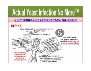 5 KEY THINGS cure CANDIDA YEAST INFECTION 
KEY #5 
 