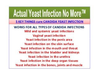 5 KEY THINGS cure CANDIDA YEAST INFECTION 
WORKS FOR ALL TYPES OF CANDIDA INFECTIONS 
Mild and systemic yeast infections 
Vaginal yeast infection 
Yeast infection iinn tthhee ppeenniiss aarreeaa 
Yeast infection on the skin surface 
Yeast infection in the mouth and throat 
Yeast infection in the bladder and kidneys 
Yeast infection in the urethra 
Yeast infection in the deep organ tissues 
Yeast infection in the bones, joints and muscle 
 
