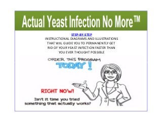STEP-BY-STEP 
INSTRUCTIONAL DIAGRAMS AND ILLUSTRATIONS 
THAT WIIL GUIDE YOU TO PERMANENTLY GET 
RID OF YOUR YEAST INFECTION FASTER THAN 
YOU EVER THOUGHT POSSIBLE 
 