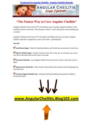 Treatment For Angular Cheilitis - Angular Cheilitis Remedy




    “The Fastest Way to Cure Angular Cheilitis”
Angular Cheilitis Free Forever™ is the fastest way of curing Angular Cheilitis in the
comfort of your own home. The best part is that it’s safe, all-natural, non-irritating and
it works!

Angular Cheilitis Free Forever™ will safely and effectively free you from Angular
Cheilitis and all its symptoms in just a few hours - permanently!

You will :

   Look Normal Again - Stop the Swelling, Redness and Tenderness around your mouth area.

   Safe For All Skin Types - It doesn't matter if your skin is oily, dry, or sensitive, you can be
sure that it will work and not harm you in any way.

   Permanent Solution - Cure Angular Cheilitis from the Source so that it will never reoccur
again.

   Enhance Your Social Life - Talk or Smile Freely without the constant worry that people are
starring at you.

   A Proven Angular Cheilitis Cure - Already Used Successfully by thousands of sufferers
around the world.




 www.AngularCheilitis.Blog102.com
 