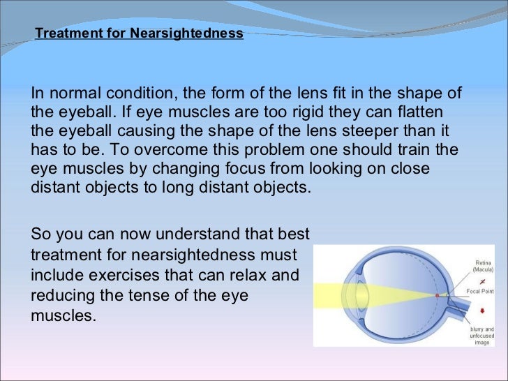 Treatment for Nearsightedness Simple Tips to Fix Myopia