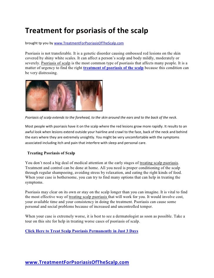 Treatment For Psoriasis Of The Scalp