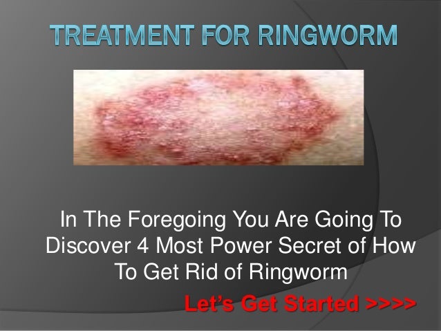 Treatment For Ringworm