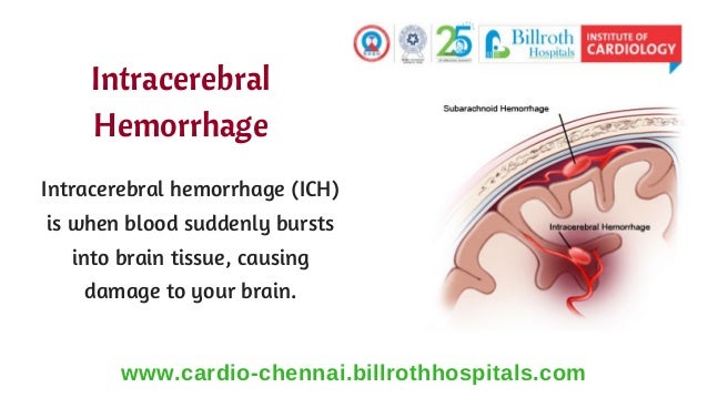 Treatment For Stroke In Tamil Nadu | | Heart Disease ...