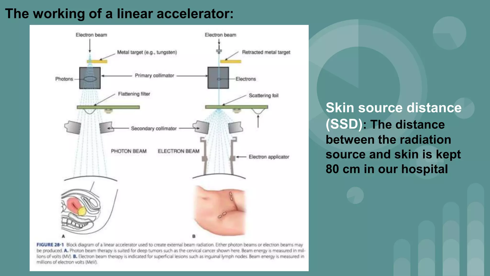 Treatment of Advanced stage of Carcinoma Cervix & Ca cervix in ...