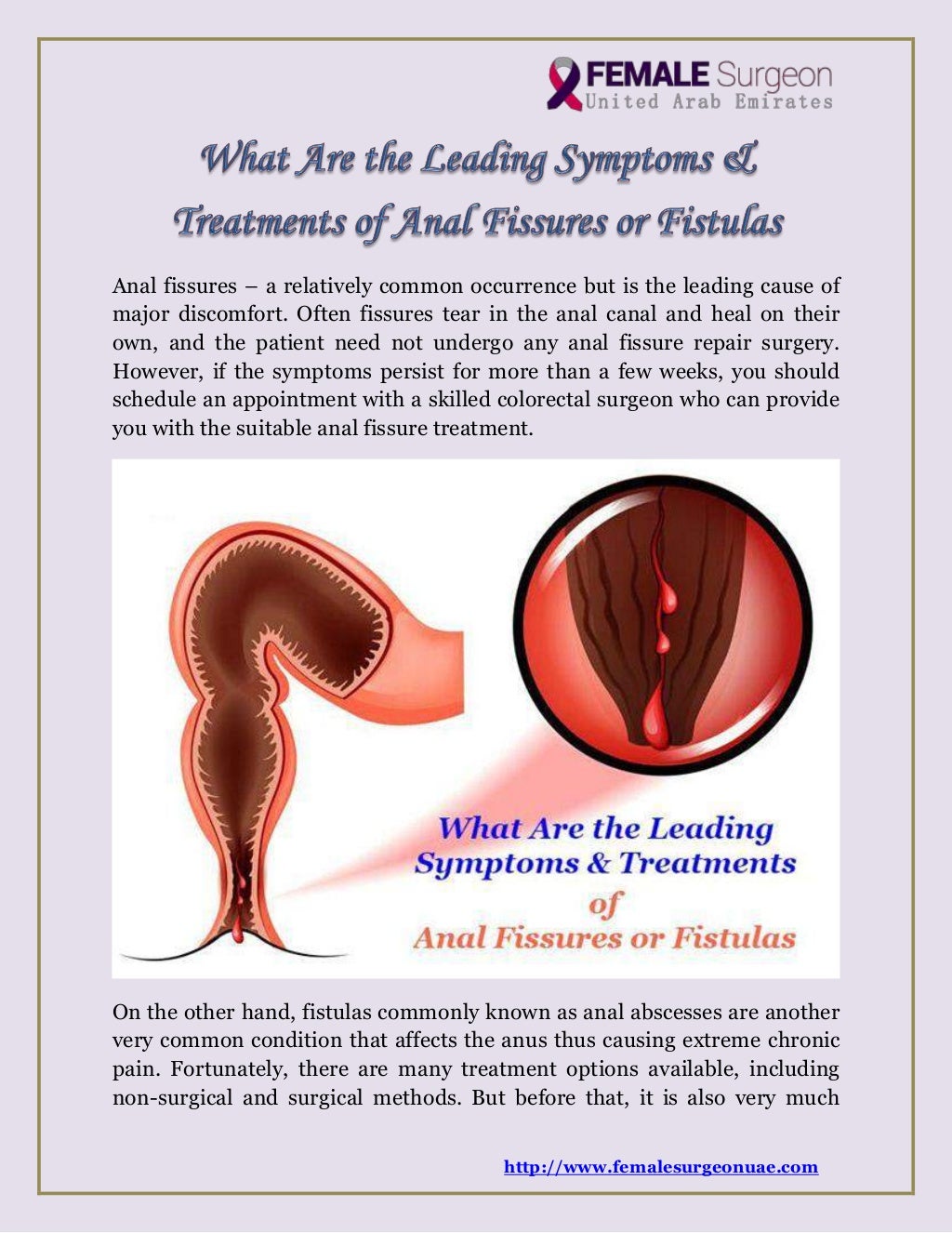 What Are the Leading Symptoms & Treatments of Anal Fissures or Fistulas