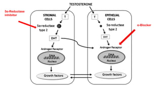 5α-Reductase
inhibitor
α-Blocker
 