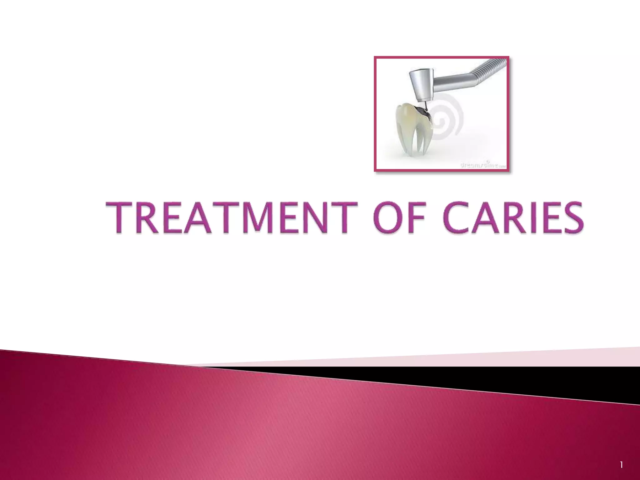 Treatment of caries SHINY MOUNICA.P PPT