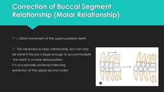 Treatment of Class II Division 1 Malocclusion.pptx