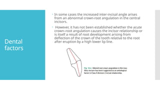Treatment of Class II Division 2 Malocclusion.pptx