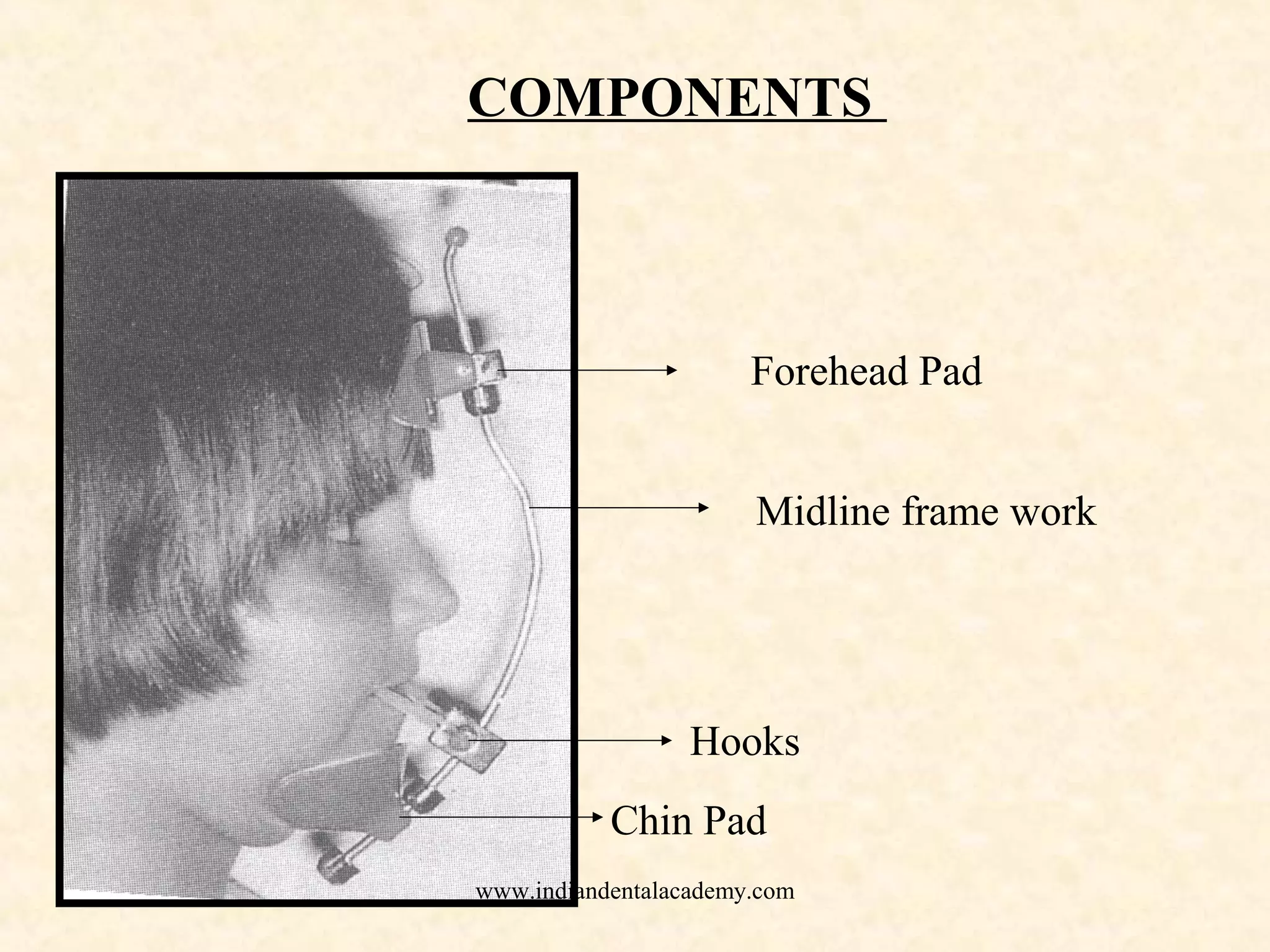 COMPONENTS
Forehead Pad
Midline frame work
Chin Pad
Hooks
www.indiandentalacademy.com
 