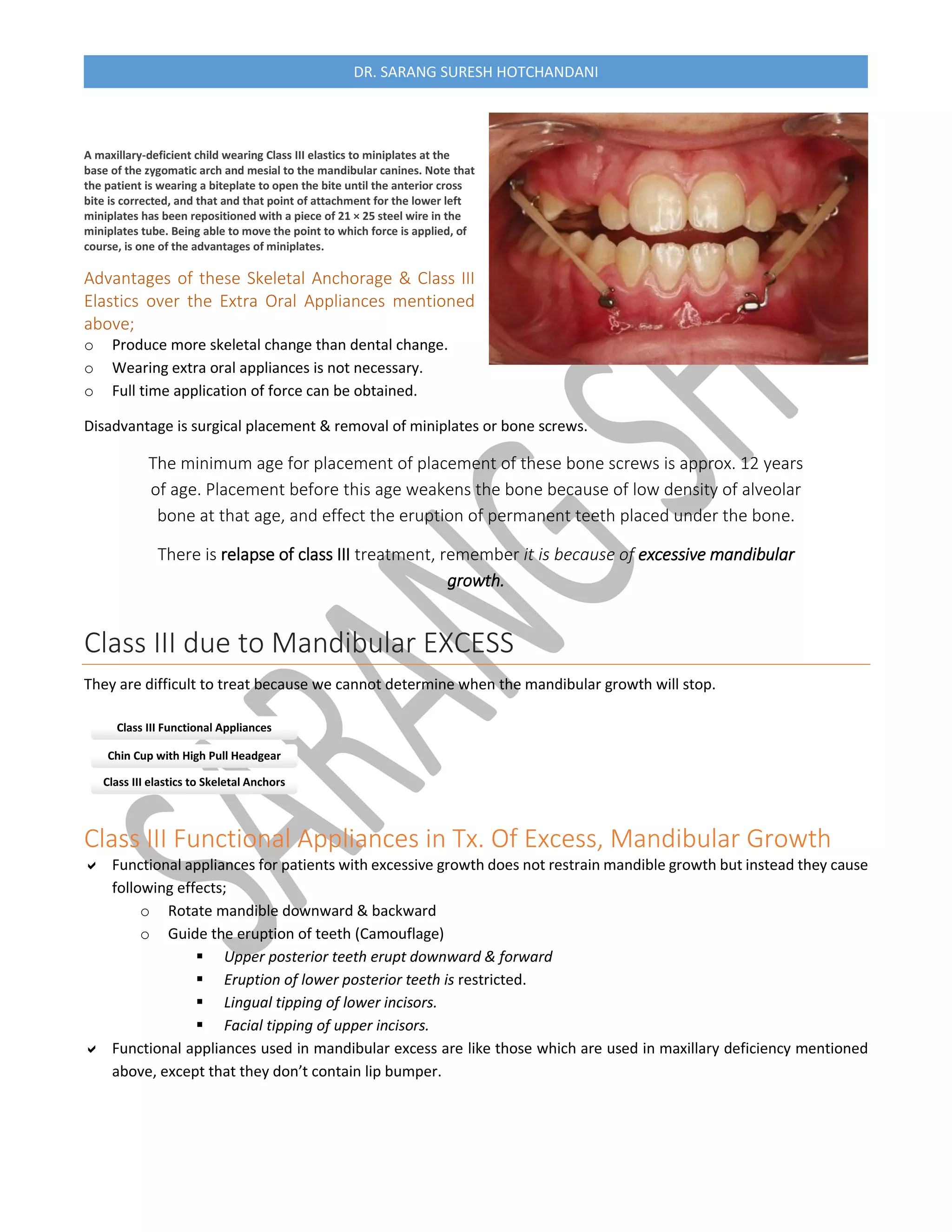 Treatment of class III Malocclusion #Orthodontics | PDF
