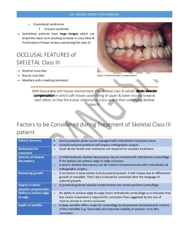 Treatment of class III Malocclusion Orthodontics