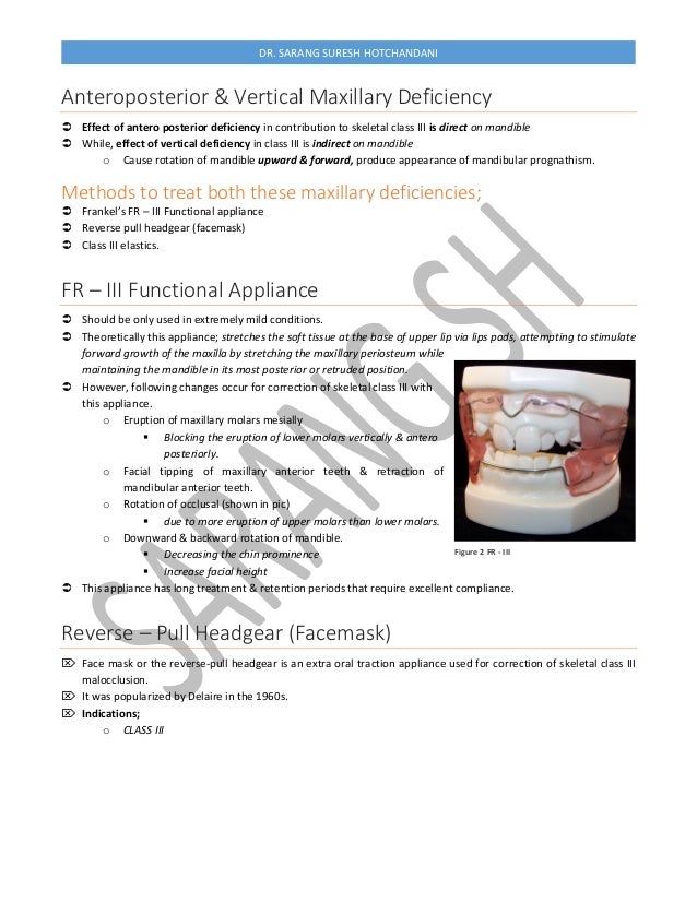 Treatment of class III Malocclusion Orthodontics
