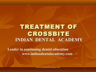 TREATMENT OF
CROSSBITE

INDIAN DENTAL ACADEMY
Leader in continuing dental education
www.indiandentalacademy.com

www.indiandentalacademy.com

 