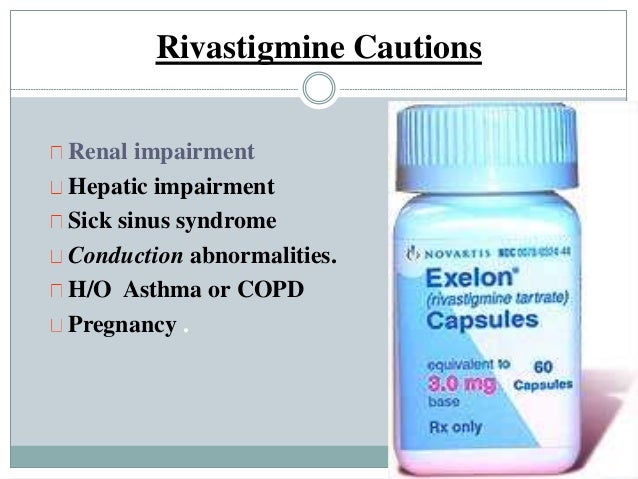 Rivastigmine Side Effects