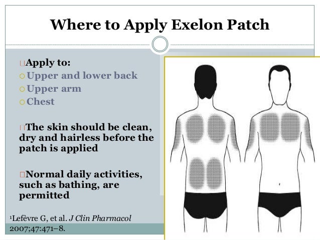 Exelon patch site rotation chart