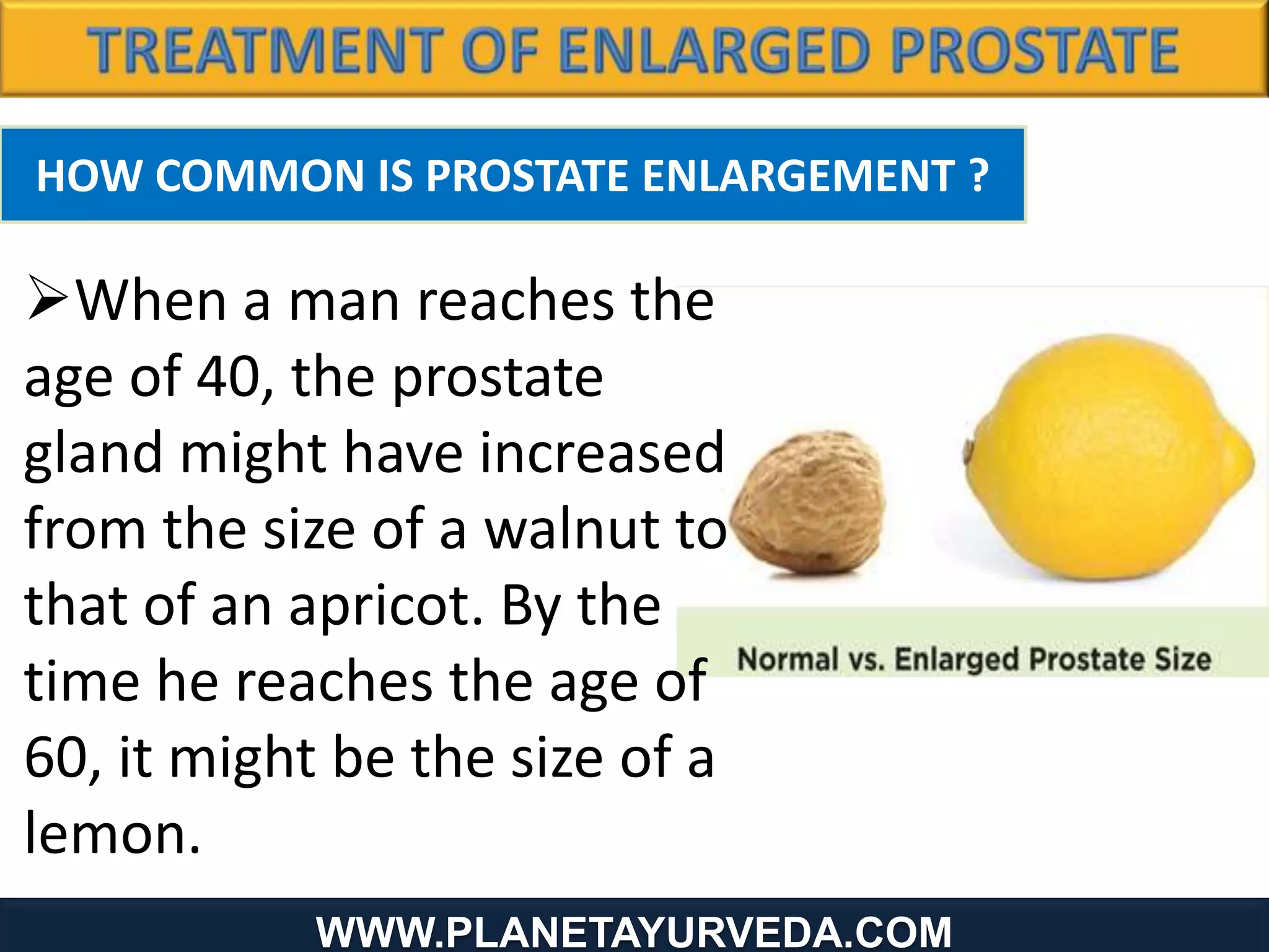 HOW COMMON IS PROSTATE ENLARGEMENT ?
When a man reaches the
age of 40, the prostate
gland might have increased
from the size of a walnut to
that of an apricot. By the
time he reaches the age of
60, it might be the size of a
lemon.
WWW.PLANETAYURVEDA.COM
 