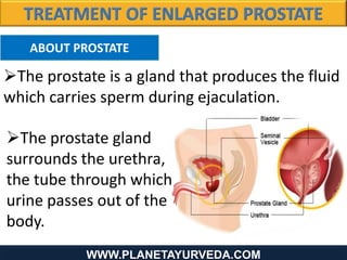 WWW.PLANETAYURVEDA.COMWWW.PLANETAYURVEDA.COM
ABOUT PROSTATE
The prostate gland
surrounds the urethra,
the tube through which
urine passes out of the
body.
The prostate is a gland that produces the fluid
which carries sperm during ejaculation.
 