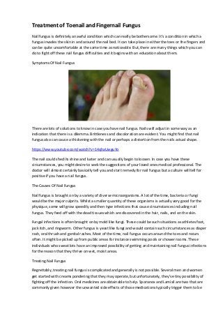Treatment of Toenail and Fingernail Fungus
Nail fungus is definitely an awful condition which can really be bothersome. It's a condition in which a
fungus invades the skin in and around the nail bed. It can take place in either the toes or the fingers and
can be quite uncomfortable at the same time as noticeable. But, there are many things which you can
do to fight off these nail fungus difficulties and it begins with an education about them.
Symptoms Of Nail Fungus
There are lots of solutions to know in case you have nail fungus. Nails will adjust in some way as an
indication that there is a dilemma. Brittleness and discoloration are evident. You might find that nail
fungus also can cause a thickening with the nail or perhaps a distortion from the nails actual shape.
https://www.youtube.com/watch?v=14qhaUwguYo
The nail could shed its shine and luster and can usually begin to loosen. In case you have these
circumstances, you might desire to seek the suggestions of your loved ones medical professional. The
doctor will almost certainly basically tell you and start remedy for nail fungus but a culture will tell for
positive if you have a nail fungus.
The Causes Of Nail Fungus
Nail fungus is brought on by a variety of diverse microorganisms. A lot of the time, bacteria or fungi
would be the major culprits. Whilst a smaller quantity of these organisms is actually very good for the
physique, some will grow speedily and then type infections that cause circumstances including nail
fungus. They feed off with the dead tissues which are discovered in the hair, nails, and on the skin.
Fungal infections is often brought on by mold like fungi. These could be such situations as athletes foot,
jock itch, and ringworm. Other fungus is yeast like fungi and would contain such circumstances as diaper
rash, oral thrush and genital rashes. Most of the time, nail fungus occurs around the toes and recurs
often. It might be picked up from public areas for instance swimming pools or shower rooms. These
individuals who sweat lots have an improved possibility of getting and maintaining nail fungus infections
for the reason that they thrive on wet, moist areas.
Treating Nail Fungus
Regrettably, treating nail fungus is complicated and generally is not possible. Several men and women
get started with creams pondering that they may operate, but unfortunately, they've tiny possibility of
fighting off the infection. Oral medicines are obtainable to help. Sporanox and Lamisil are two that are
commonly given however the unwanted side effects of those medications typically trigger them to be
 